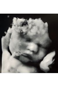 Baby Angel  Resendez